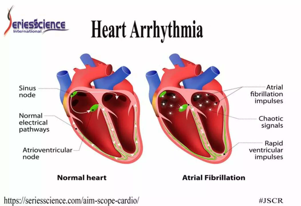 Amiodarone in Atrial Fibrillation: A Review of Recent Studies and Developments