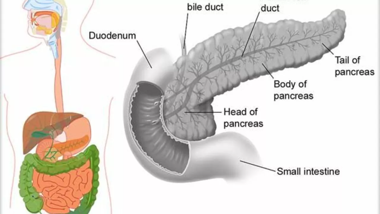 Pancreatic Duct Blockage: Success Stories and Inspirational Journeys